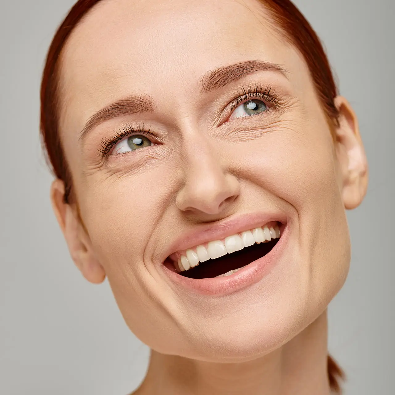 veneers